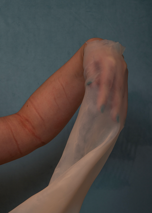 Between she and her (Peel)